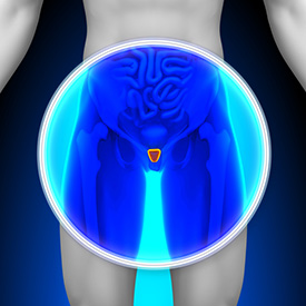 Enlarged Prostate Treatment in Roswell, GA