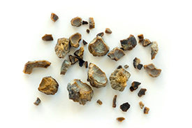 Kidney Stone Treatment in Holiday, FL